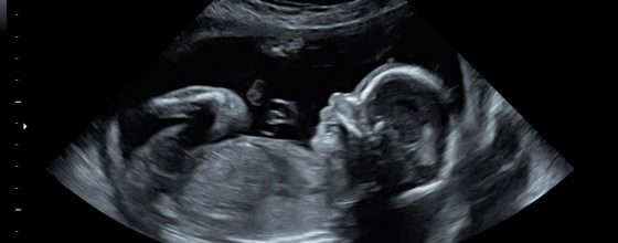 What’s Different With Baby 4? What’s Different With Baby 4?